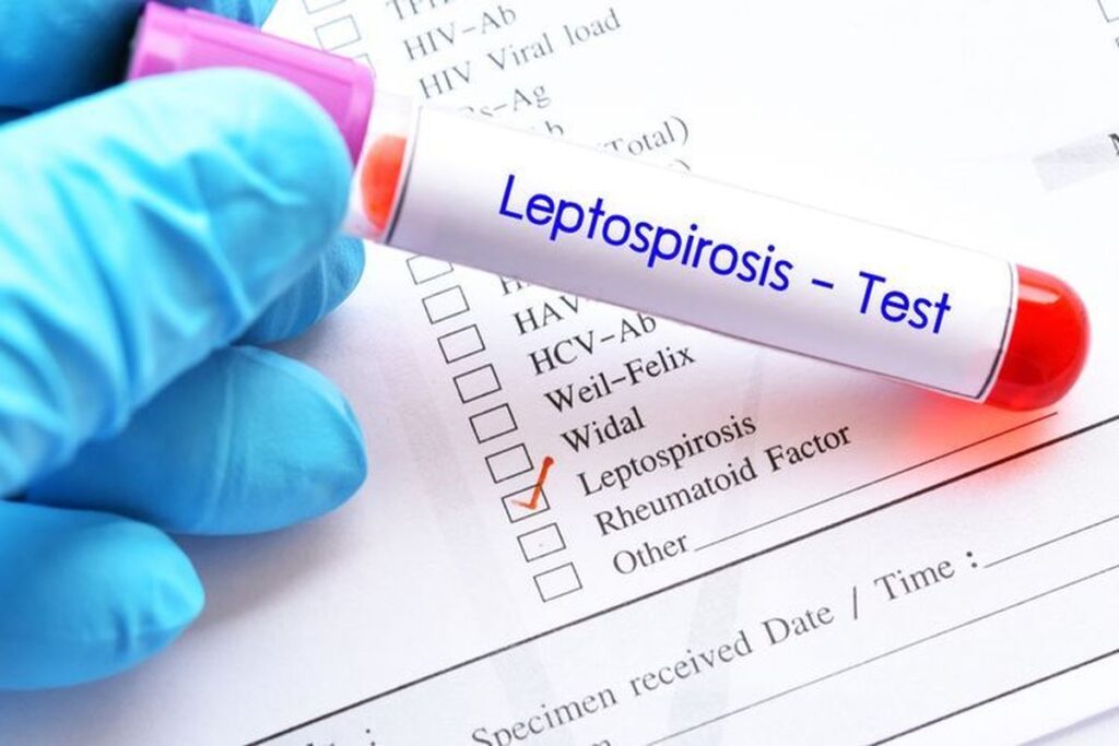 Lima Korban Jiwa Pemda Yogyakarta Imbau Waspada Leptospirosis yang Tewaskan 5 dari 18 Kasus