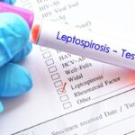 Lima Korban Jiwa Pemda Yogyakarta Imbau Waspada Leptospirosis yang Tewaskan 5 dari 18 Kasus