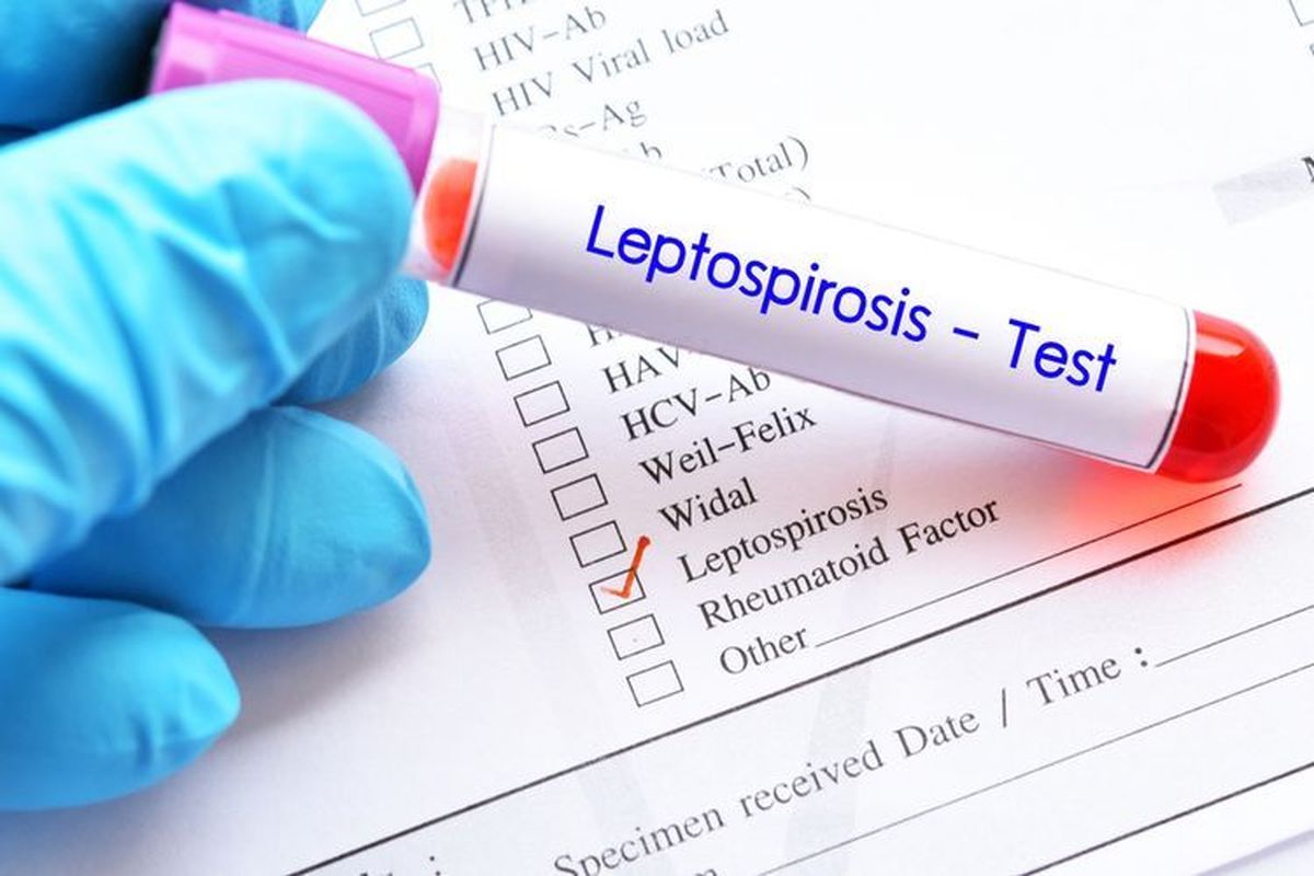 Lima Korban Jiwa Pemda Yogyakarta Imbau Waspada Leptospirosis yang Tewaskan 5 dari 18 Kasus